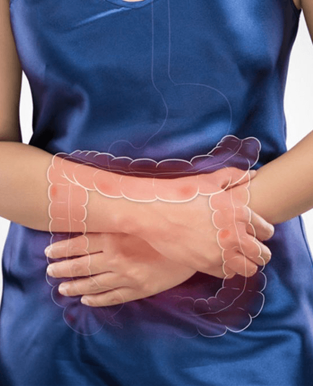 bowel-intestinal-obstruction-cause-and-cure-class-chennai